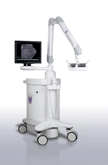 Imagen: El dispositivo somo•v ABUS (Fotografía cortesía de U-Systems).